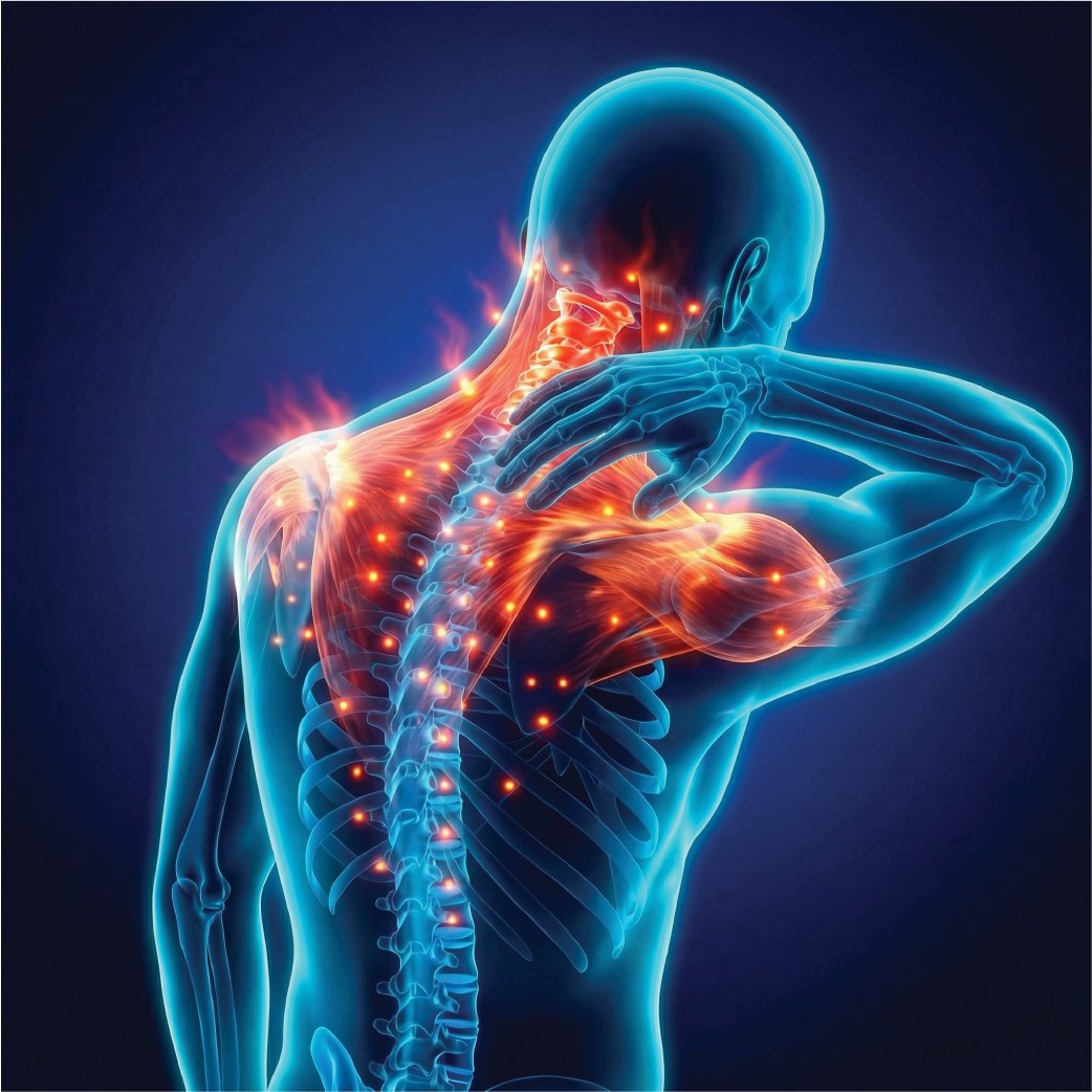 Back pain relief use case